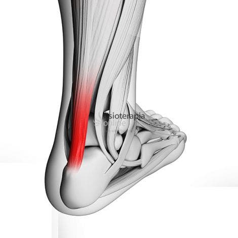 Tendon tendinitis de tratar como aquiles el en